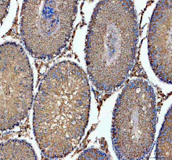 a02479 3 kars1 primary antibodies ihc testing 3
