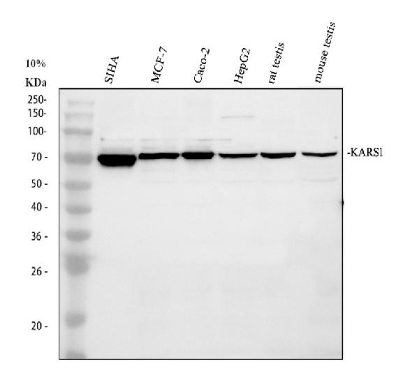 Western blot analysis of KARS1 using anti-KARS1 antibody (A02479-3)