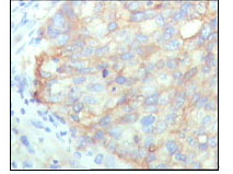 a02479 kars primary antibodies ihc testing 1