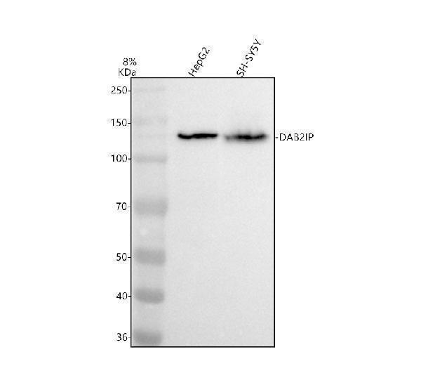 Western blot analysis of DAB2IP using anti-DAB2IP antibody (A02480)
