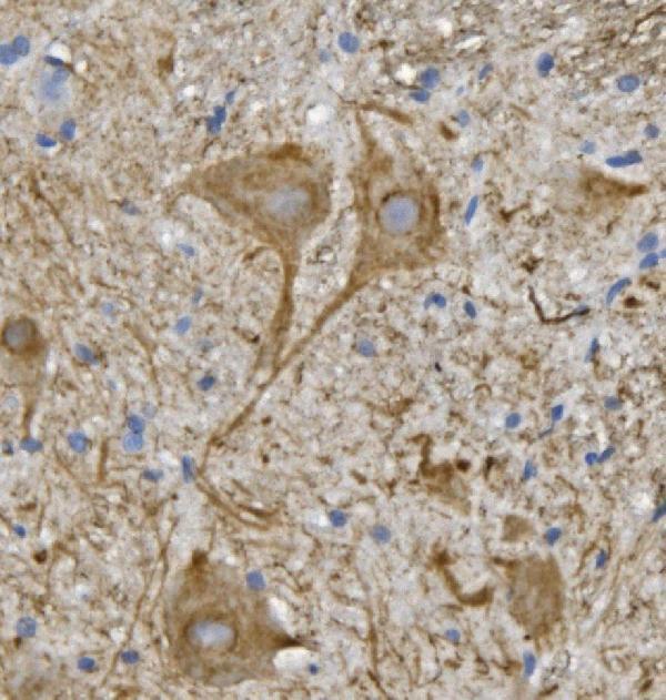 a02482 1 nefl primary antibodies ihc testing 2