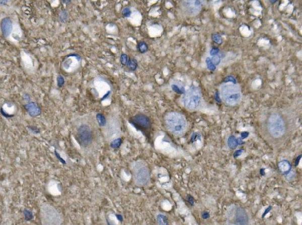 a02482 1 nefl primary antibodies ihc testing 4