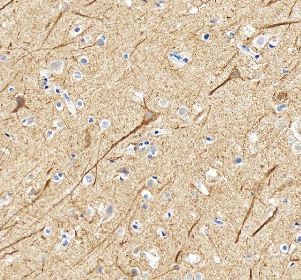 a02482 1 nefl primary antibodies ihc testing 4_1