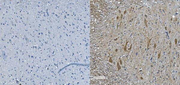 a02482 1 nefl primary antibodies ihc testing 5