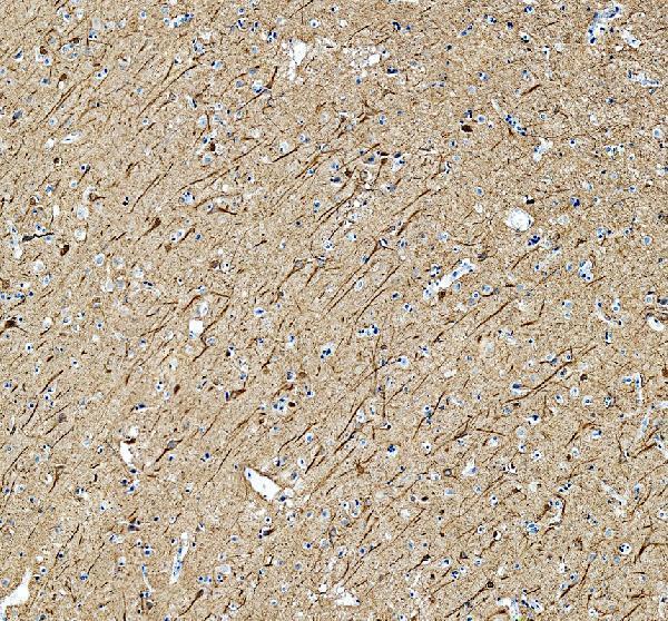 a02482 1 nefl primary antibodies ihc testing 6