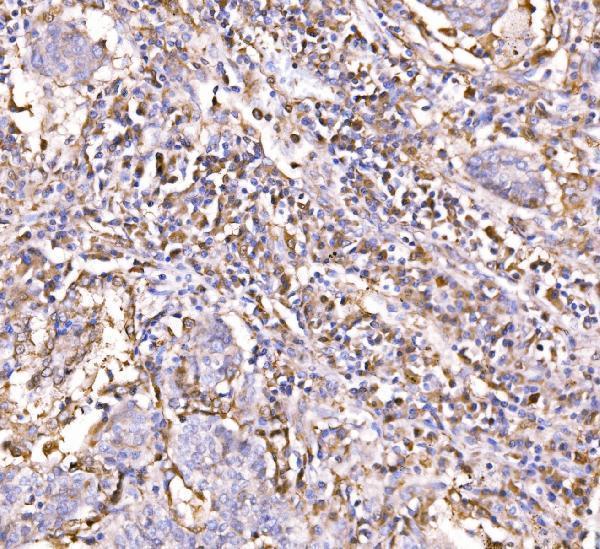 a02483 3 rapgef3 primary antibodies ihc testing 2