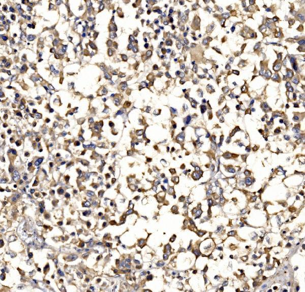 a02483 3 rapgef3 primary antibodies ihc testing 3