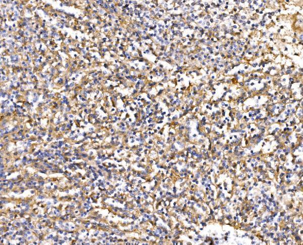 a02483 3 rapgef3 primary antibodies ihc testing 4