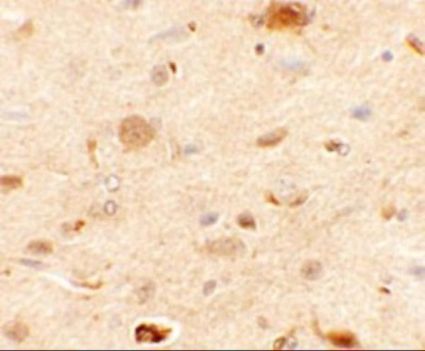 a02483 rapgef3 primary antibodies ihc testing 2