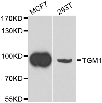 a02484 tgm1 primary antiboties wb testing 1