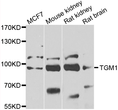 a02484 tgm1 primary antiboties wb testing 2