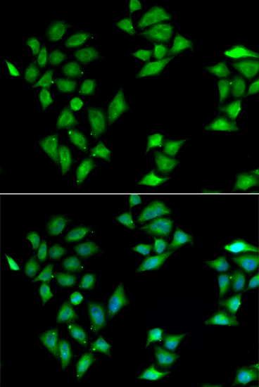 a02485 itln1 primary antiboties ihc testing 2