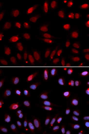 Immunofluorescence analysis of U20S cell using HUS1 antibody