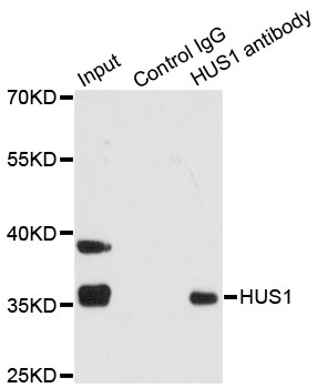Immunoprecipitation analysis of 200ug extracts of 293T cells using 1ug HUS1 antibody at a dilition of 1:1000