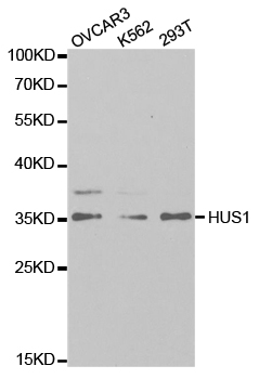 Western blot analysis of extracts of various cell lines, using HUS1 antibody at 1:1000 dilution