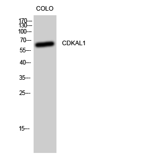 a02489 cdkal1 primary antibodyes wb testing 1