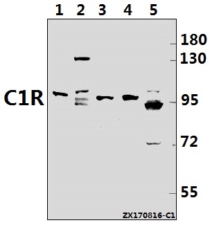 Western blot (WB) analysis of C1R pAb at 1:500 dilution
Lane1:Hela whole cell lysate(40ug)
Lane2:HepG2 whole cell lysate(40ug)
Lane3:MEF whole cell lysate(40ug)
Lane4:C6 whole cell lysate(40ug)
Lane5:U-87MG whole cell lysate(40ug)