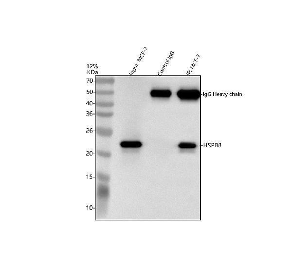 a02492 2 hspb8 primary antibodies ip testing 8