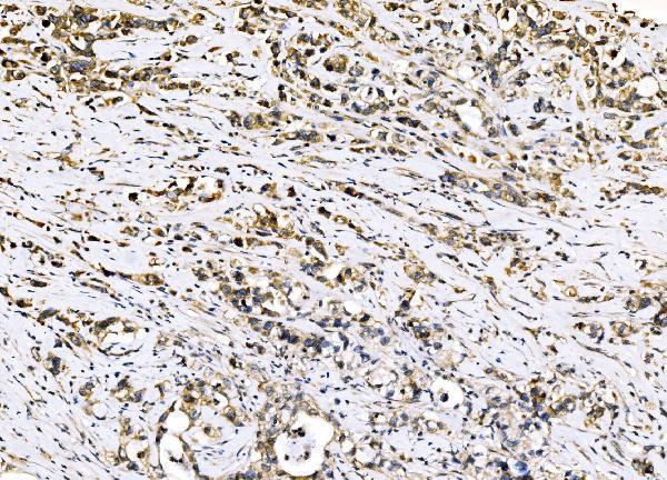 a02493 2 sigmar1 primary antibodies ihc testing 5