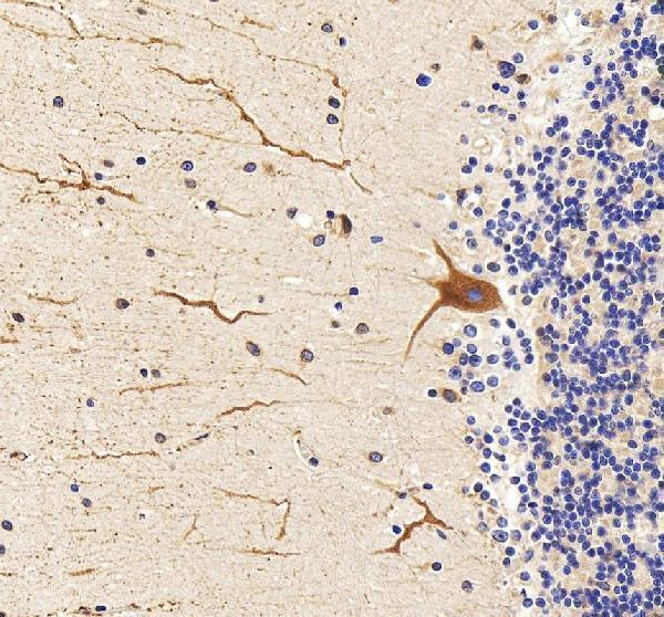 IHC analysis of SIGMAR1 using anti-SIGMAR1 antibody (A02493-2)