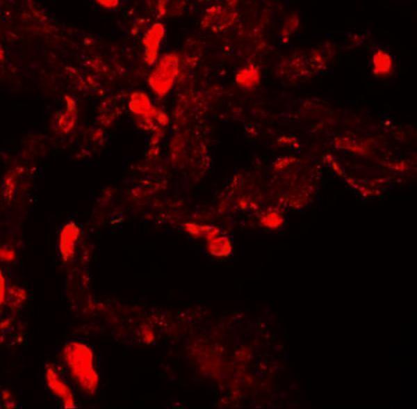 a02494 ezh1 primary antibodies if testing 3