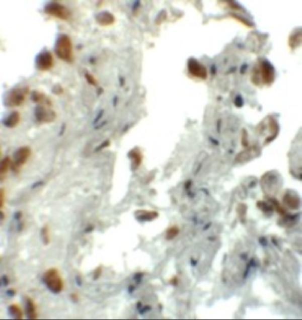 a02494 ezh1 primary antibodies ihc testing 2