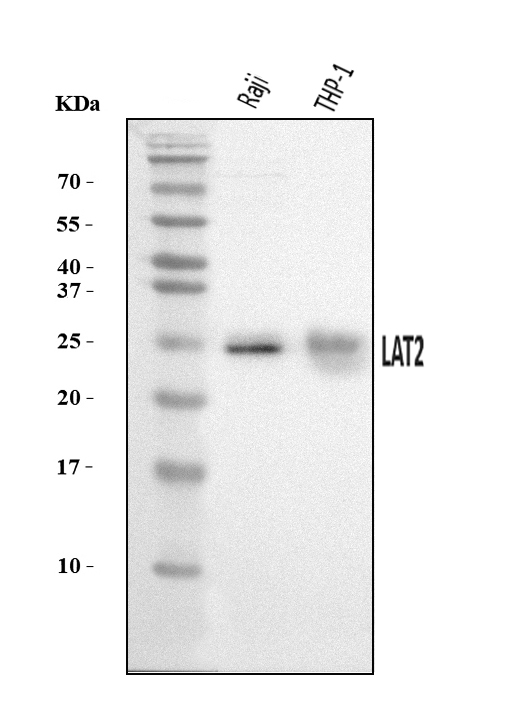  Western blot analysis of NTAL/LAT2 using anti-NTAL/LAT2 antibody (A02496-1)