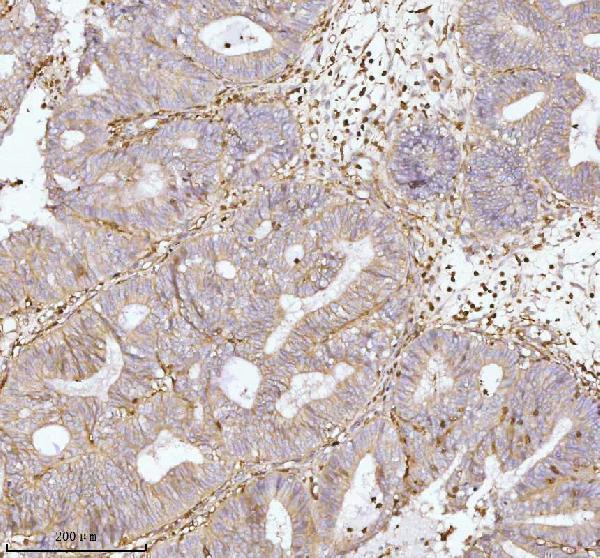  IHC analysis of GNAI2 using anti-GNAI2 antibody (A02498-3)