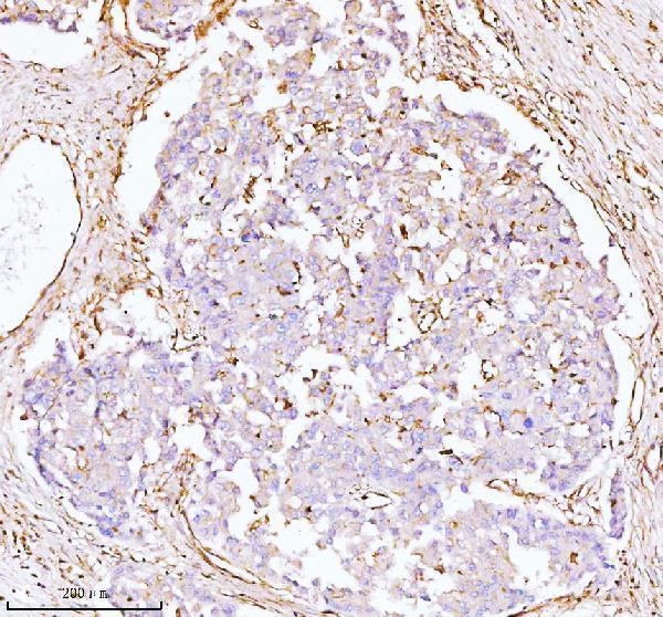  IHC analysis of GNAI2 using anti-GNAI2 antibody (A02498-3)