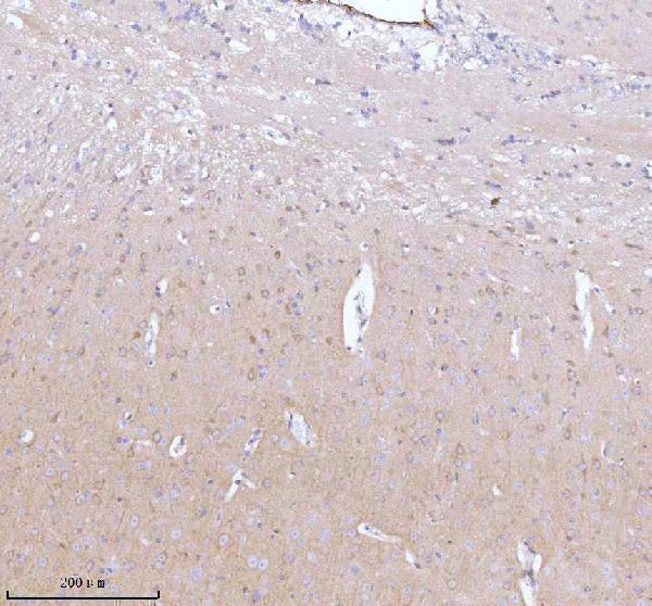 a02498 3 gnai2 primary antibodies ihc testing 5