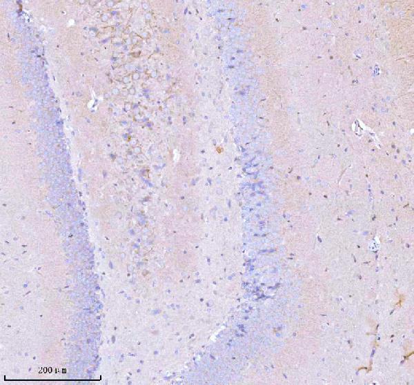a02498 3 gnai2 primary antibodies ihc testing 6