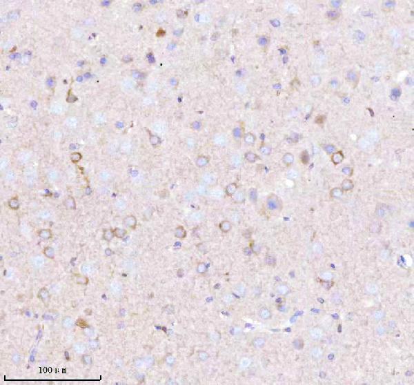 a02498 3 gnai2 primary antibodies ihc testing 7