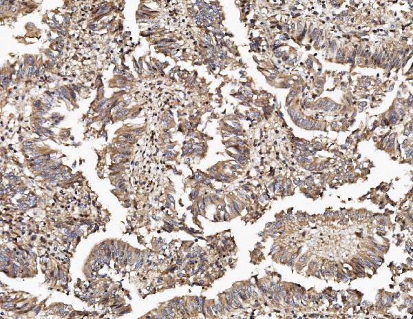 a02499 1 tab2 primary antibodies ihc testing 2