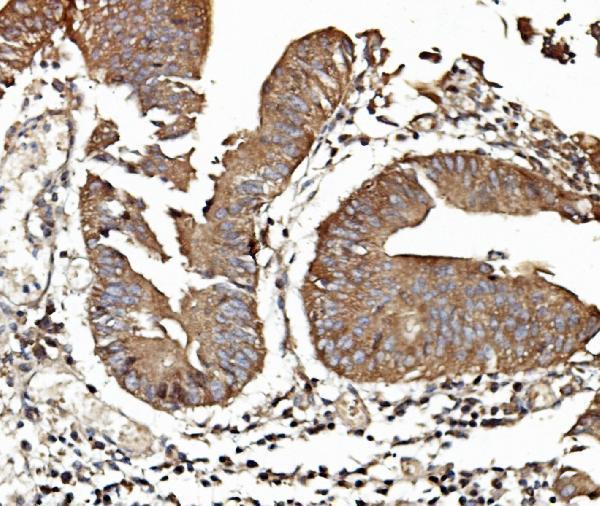 a02499 1 tab2 primary antibodies ihc testing 3