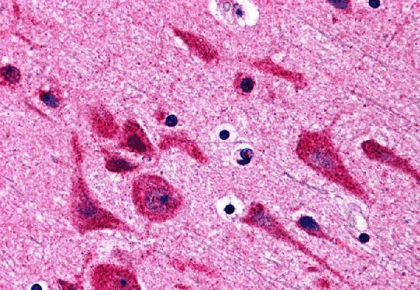 Immunohistochemistry of TAB2 in human brain tissue with TAB2 antibody at 5 μg/mL
