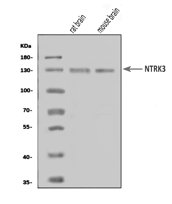  Western blot analysis of TrkC/NTRK3 using anti-TrkC/NTRK3 antibody (A02502-2)
