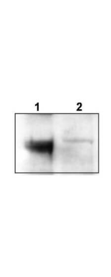 Western blot using Boster