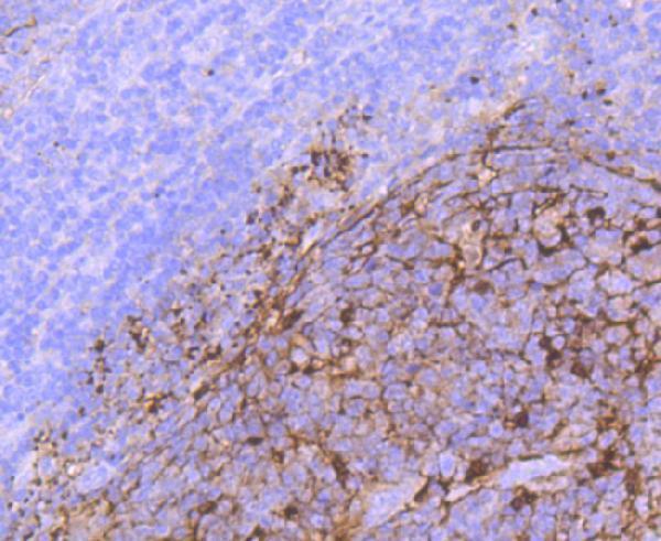 a02503s100 1 s100a1 primary antiboties ihc testing 2