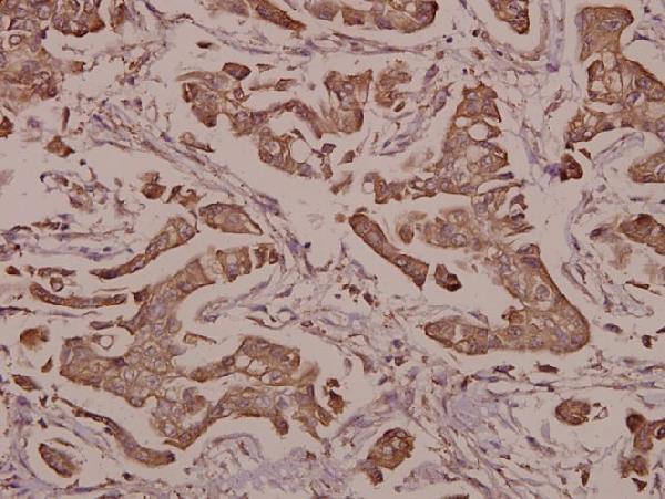 a02503s100 s100a1 primary antiboties ihc testing 2