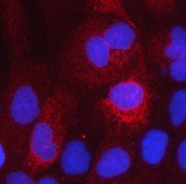  IF analysis of HSD17B2 using anti-HSD17B2 antibody (A02506-1)