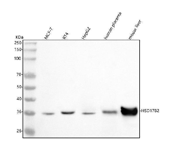  Western blot analysis of HSD17B2 using anti-HSD17B2 antibody (A02506-1)