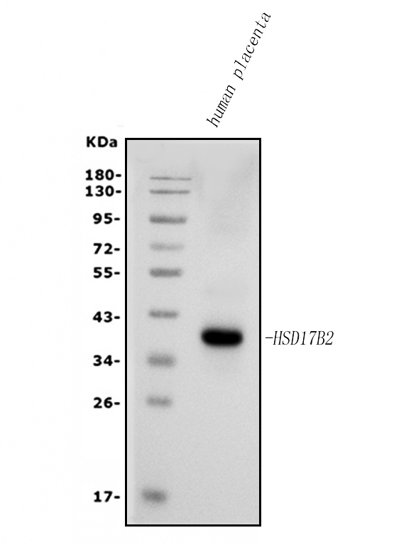  Western blot analysis of HSD17B2 using anti-HSD17B2 antibody (A02506)