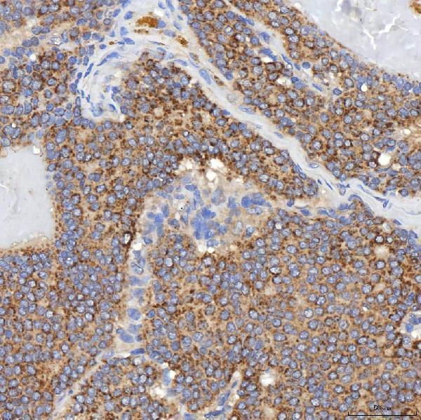  IHC analysis of SGCE using anti-SGCE antibody (A02507-1)