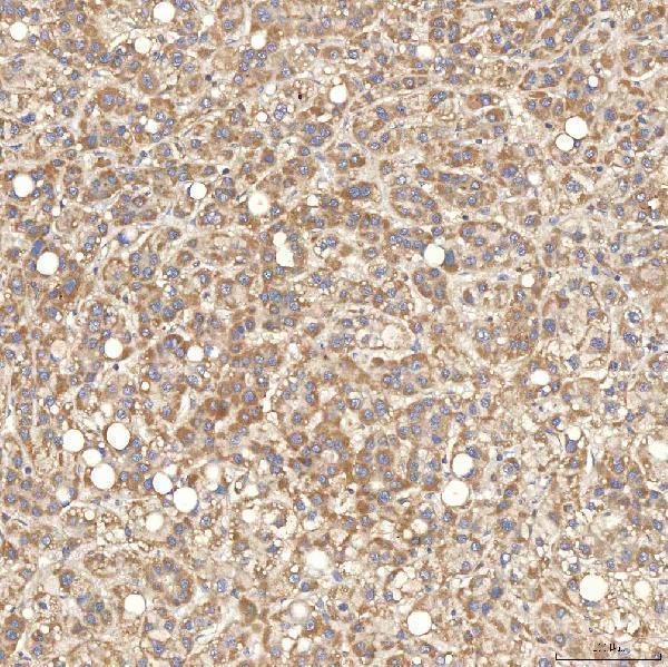  IHC analysis of SGCE using anti-SGCE antibody (A02507-1)