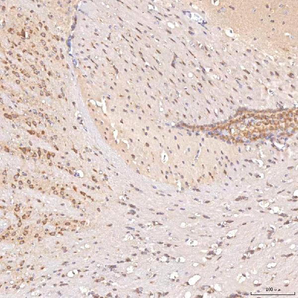 a02507 1 sgce primary antibodies ihc testing 6