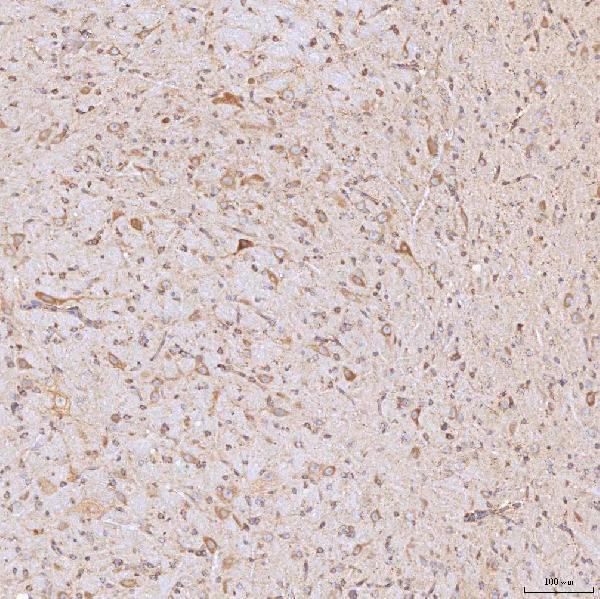 a02507 1 sgce primary antibodies ihc testing 7