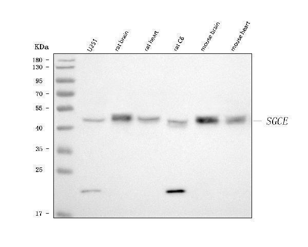  Western blot analysis of SGCE using anti-SGCE antibody (A02507-1)