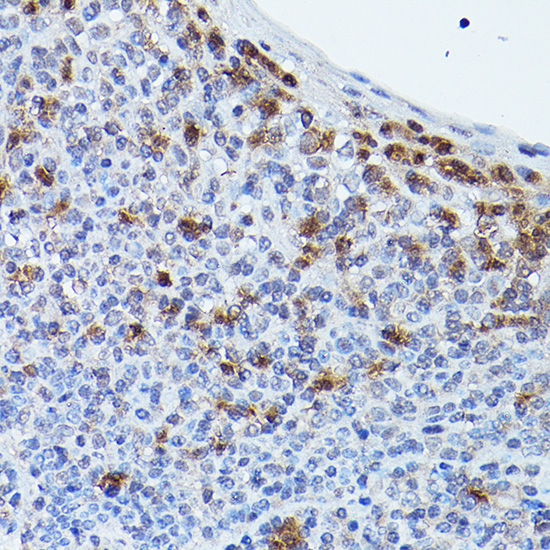a02511 hcar2 primary antiboties ihc testing 2