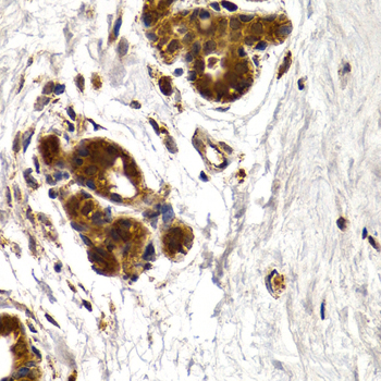 Immunohistochemistry of paraffin-embedded human mammary gland using CTSS antibody  at dilution of 1:200 