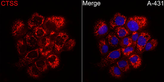 Western blot analysis of extracts of Rat brain, using CTSS antibody  at 1:500 dilution